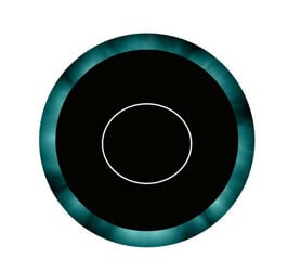 Before: cornea oval. astigmatism steep at 90 degrees