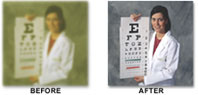 Effects of Cataract Surgery - Before and After